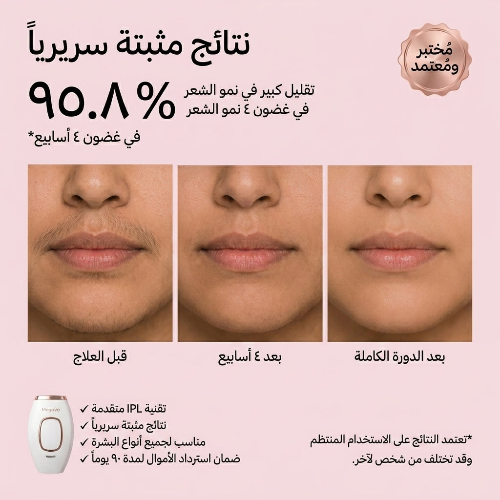 جهاز IPL لإزالة الشعر من المنزل