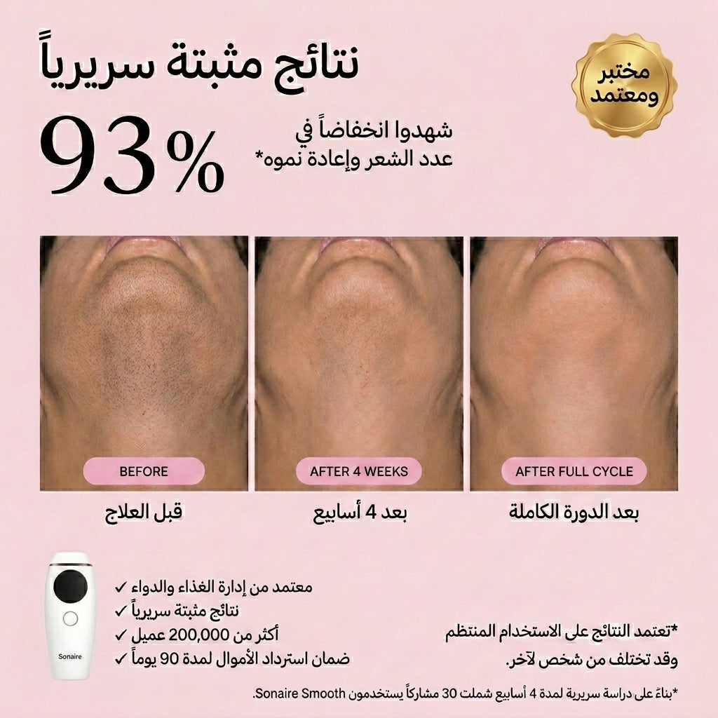جهاز IPL لإزالة الشعر من المنزل