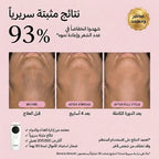 جهاز IPL لإزالة الشعر من المنزل