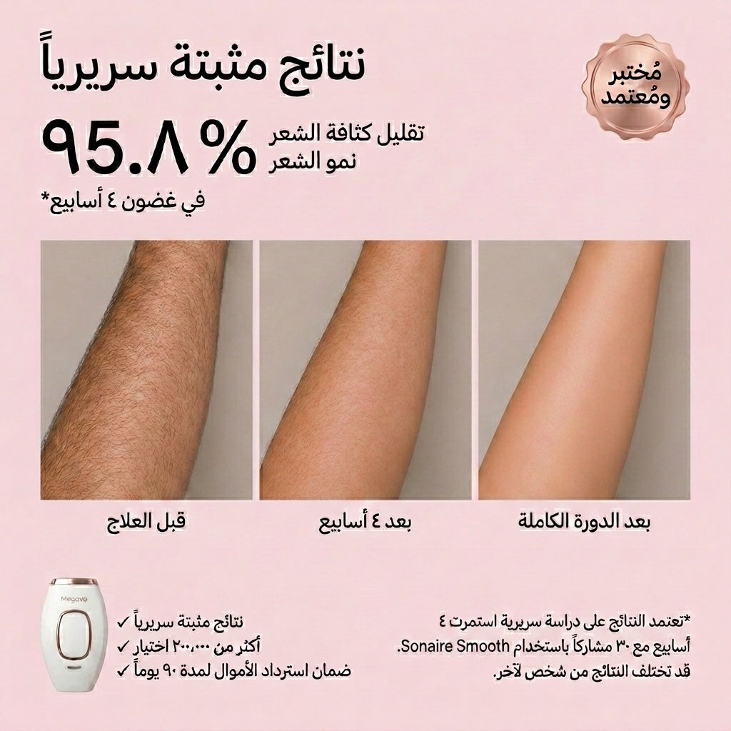 جهاز IPL لإزالة الشعر من المنزل